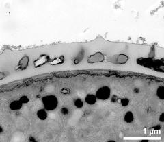 interapertural area of pollen wall