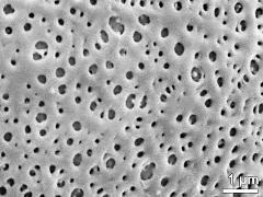 exine surface