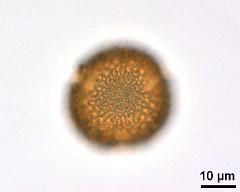 acetolyzed pollen,polar view,lower focus