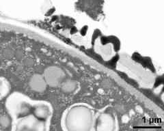 pollen wall at transition of aperture and interapertural area