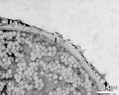 apertural area of pollen wall, intine (I)