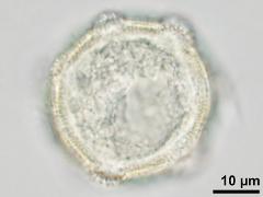 hydrated pollen,pantoporate,ornamented aperture membrane