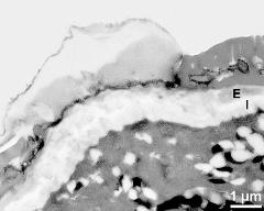 apertural area of pollen wall, intine (I), endexine (E)