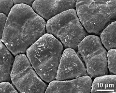 hydrated tetrads (forming massula)