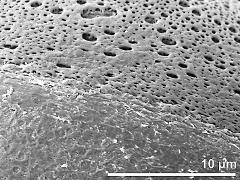 sulcus border