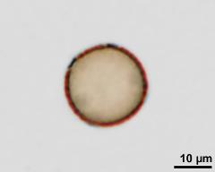 acetolysed pollen, lower focus