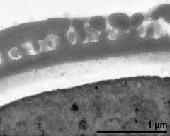 interapertural area of pollen wall