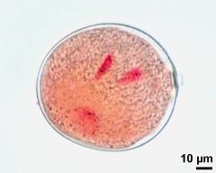 pollen grain with vegetative nucleus and two sperm cells