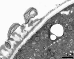 pollen wall at transition of aperture and interapertural area