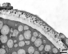 apertural area of pollen wall