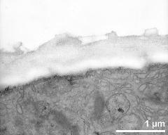 apertural area of pollen wall