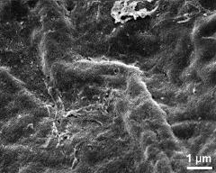 exine surface of hydrated tetrad