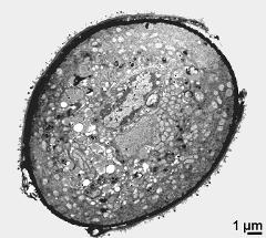 pollen grain