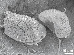 dry pollen,Ubisch bodies on locule wall
