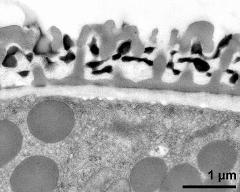 pollen wall; interapertural area