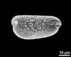 dry pollen grain in polar view (proximal)