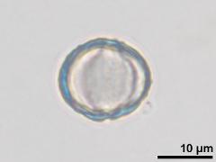 equatorial view,acetolyzed pollen