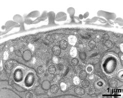 pollen wall, interapertural area