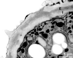 apertural area of pollen wall, intine (I), endexine (E)