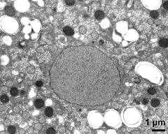 vegetative cytoplasm with organells