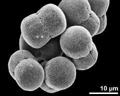 dry pollen grains