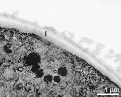 pollen wall at transition of aperture and interapertural area