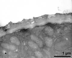 apertural area of pollen wall