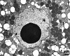 vegetative nucleus with nucleolus