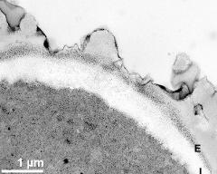 apertural area of pollen wall, intine (I), endexine (E)