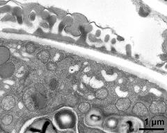 pollen wall at transition of aperture and interapertural area