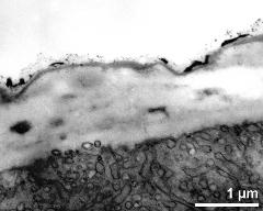 apertural area of pollen wall