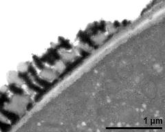 pollen wall at transition of aperture and interapertural area