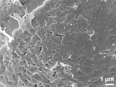 exine surface