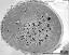 pollen grain in cross section