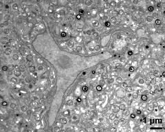 generative cell and vegetative nucleus (left)