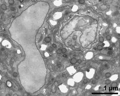 vegetative nucleus and generative cell (right)