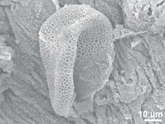 Ubisch bodies on locule wall,dry pollen