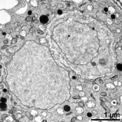 generative cell (top right) and vegetative nucleus