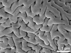 Sculpture in interapertural area,equatorial region