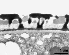 pollen wall; interapertural area