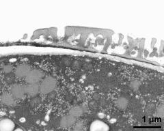 pollen wall at transition of aperture and interapertural area