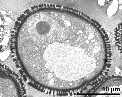 cross section of pollen grain (young microspore)