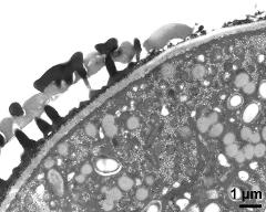 pollen wall at transition of aperture and interapertural area