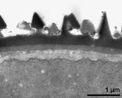 interapertural area of pollen wall