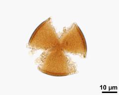 acetolyzed pollen, optical section