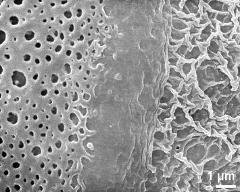 sulcus border