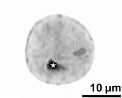 generative cell (asterisk) and vegetative nucleus