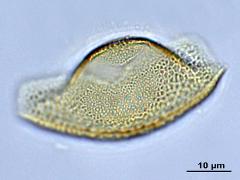 acetolyzed pollen,equatorial view