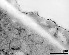 pollen wall at transition of aperture and interapertural area