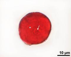 pollen grain with vegetative nucleus (asterisk) and generative cell (arrow)